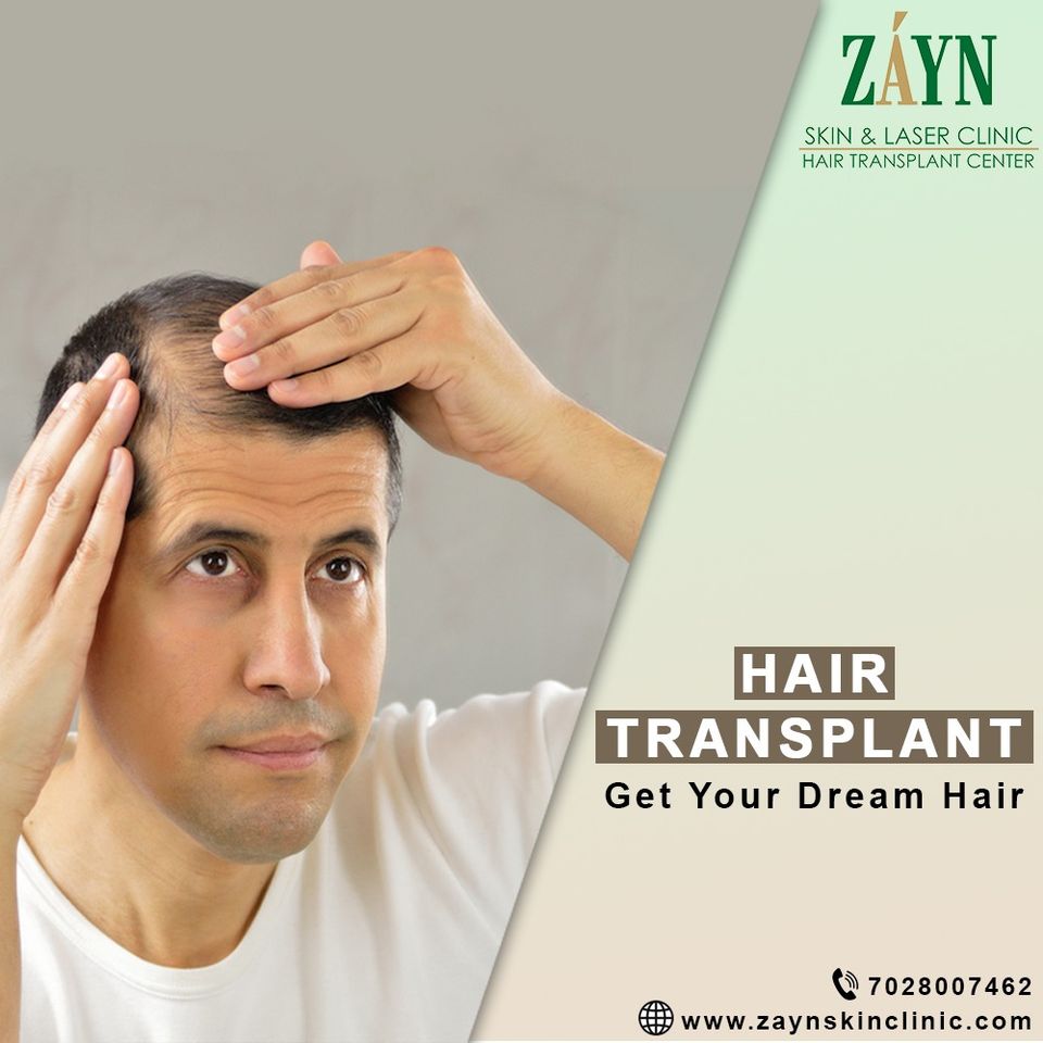 Zayn hair transplant in Pune is persuading the chance to be notable nowadays.